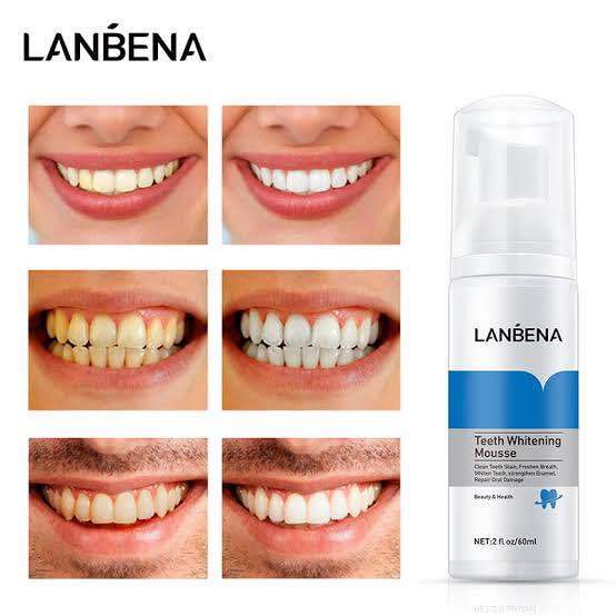 LANBENA Teeth Whitening Mousse (60ml) Rich & Delicate Foam - Clean Teeth Stain, Freshen Breath, Whiten Teeth, Strengthen Enamel, Repair Oral Damage
