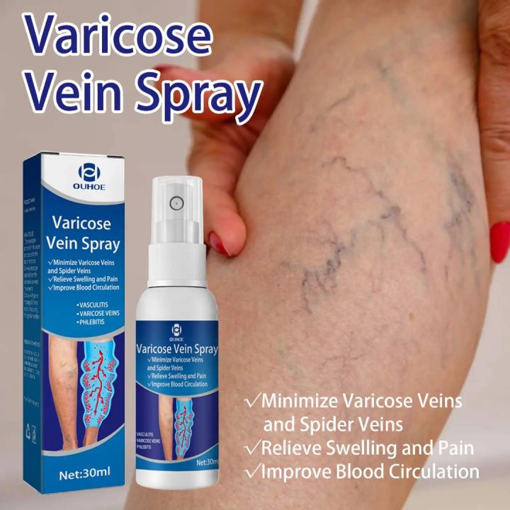 OUHOE%20Varicose%20Vein%20Spray%20(30ml)%20-%20Image%202