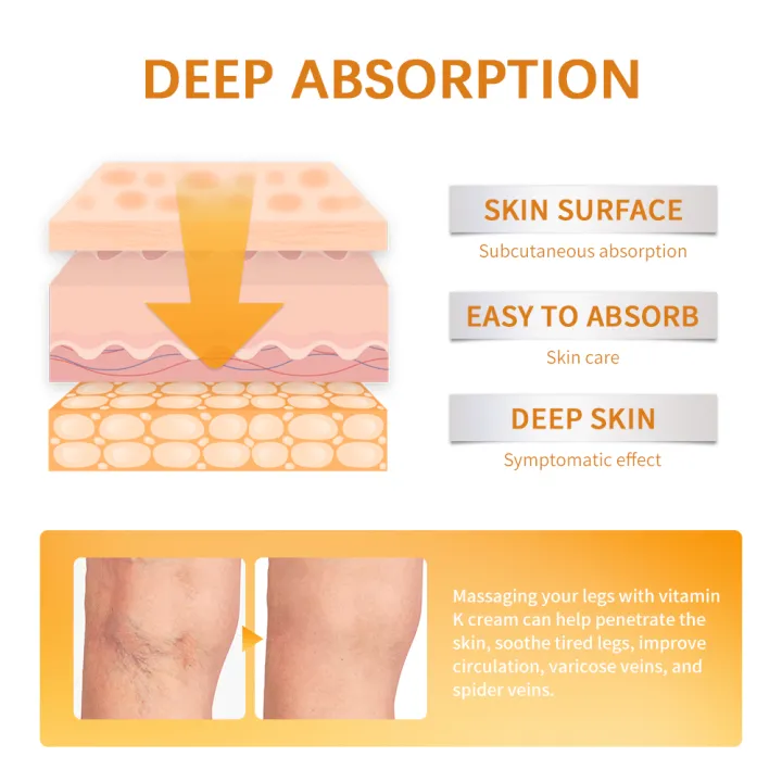 Vitamin%20K%20Cream%20Anti-aging%20And%20Wrinkle%20Removal%20Varicose%20Vein%20Relief%20Cream%20Massage%20Care%20Relieve%20Leg%20Soreness%20Swelling%20Ointment%20-%20Image%205