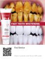 Strong Whitening Toothpaste SP-4, 120g Probiotic Whitening Toothpaste Brightening & Stain Removing Probiotic Caries Toothpaste Fresh Breath Teeth Whiten Toothpaste 5 Ratings, #lazbin. 