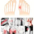1 Pair Super Elastic Bunion Sleeve Bunion Corrector Protector PreventHallux Valgus - Foot Caring Toe Corrector. 