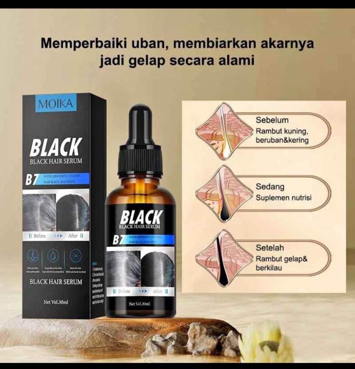 MOIKA%20Black%20Hair%20Essence%20%7C%20Anti-Hair%20Loss,%20Growth%20Booster,%20Revitalize%20with%20Lustrous%20Black%20Shine,%20Professional%20Hair%20Care%2030ml%20-%20Image%204