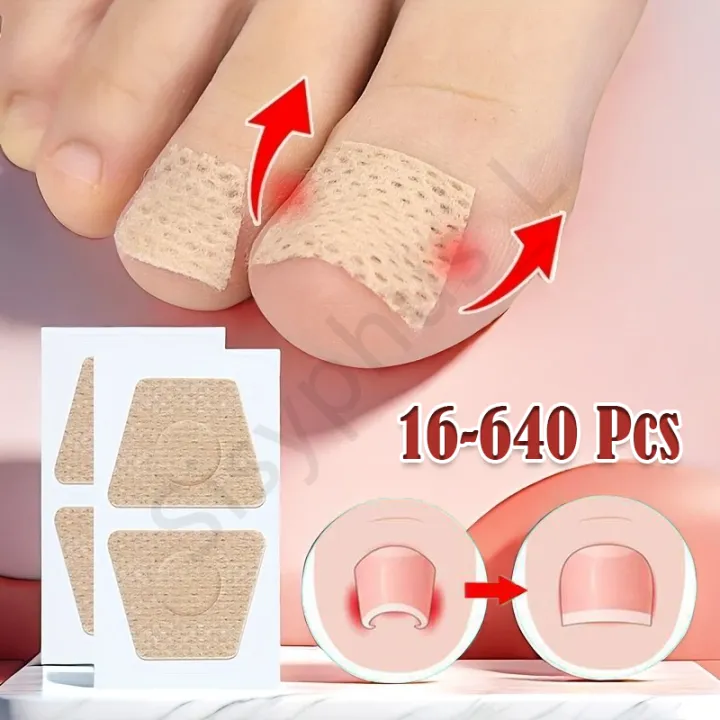 16-640 Pcs Ingrown Toenail Corrective Stickers Foot Care Ringworm ...