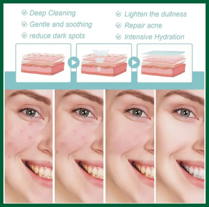 FORT%20Acne%20Clear%20Face%20Wash%20-%20Salicylic%20Acid%20Cleanser%20for%20Oil%20Control%20&%20Anti-Acne%20%7C%20Acne%20skin%20care%20products%20Reduces%20Blackheads%20&%20Whiteheads%20100ml%20-%20Image%203