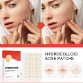 144pcs/set Face Skin Care Acne Pimple Patch 2 Sizes Invisible Professional Healing Absorbing Spot Sticker Covering for Men Women. 