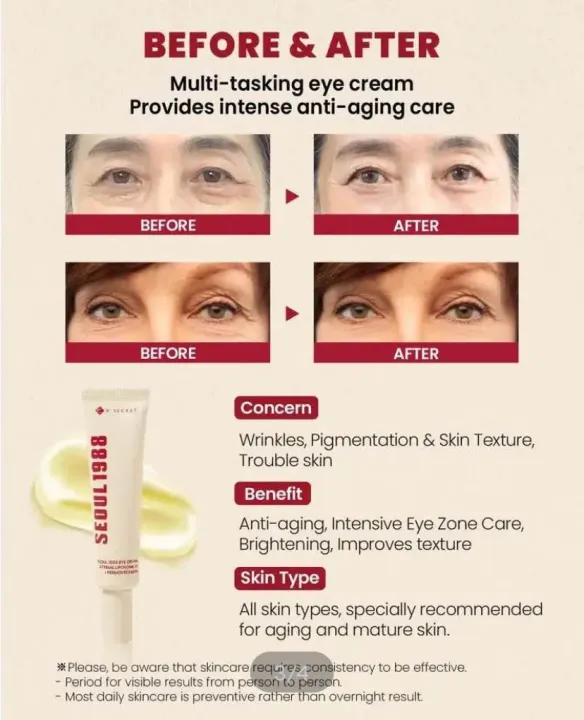 KSECRET%20SEOUL%201988%20EYE%20CREAM%20:%20RETINAL%20LIPOSOME%204%25%20+%20FERMENTED%20BEAN%2030ML%20-%20Image%203