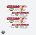 Jhalak Acne out cream tube. 
