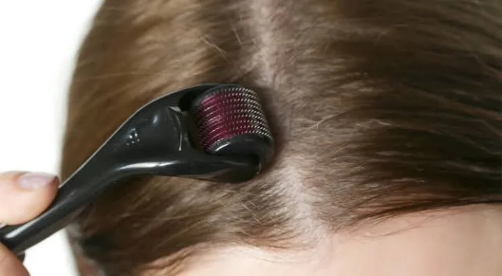Derma%20Roller%20(0.5%20mm)%20Professional%20Titanium%20Microneedle%20Derma%20Roller%20Hair%20Regrowth%20Acne%20Scars%20Anti-aging%20Skin%20Therapy%20Dermatology%20System%20-%20Image%205
