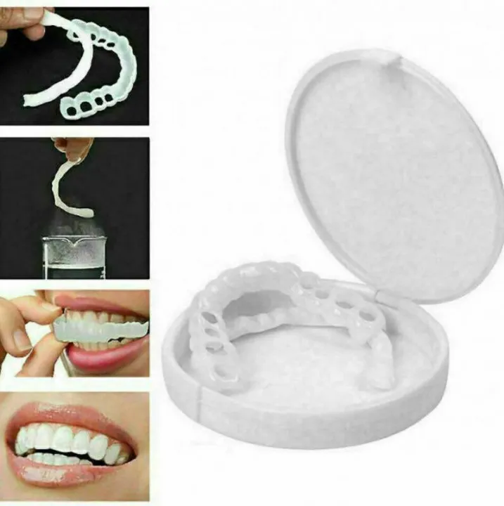 Teeth%20Braces%20Snap%20On%20Smile%20Veneers%20%7C%20Transparent%20Veneer%20Teeth%20Cover%20%7C%20Artificial%20&%20Fake%20Teeth%20Braces%20for%20Gap,%20Overbite,%20Girls%20%7C%20Snap%20On%20Teeth%20Upper%20&%20Lower%20%7C%20Invisible%20Silicone%20Dental%20Veneer%20in%20Pakistan%20-%20Image%204