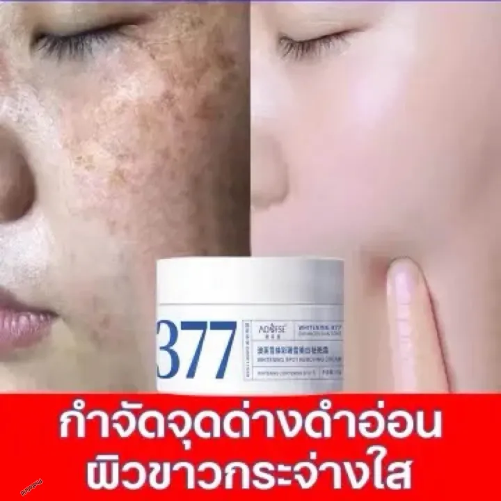 377%20Whitening%20Spot%20Removal%20Cream%2050%20GM%20-%20Image%208