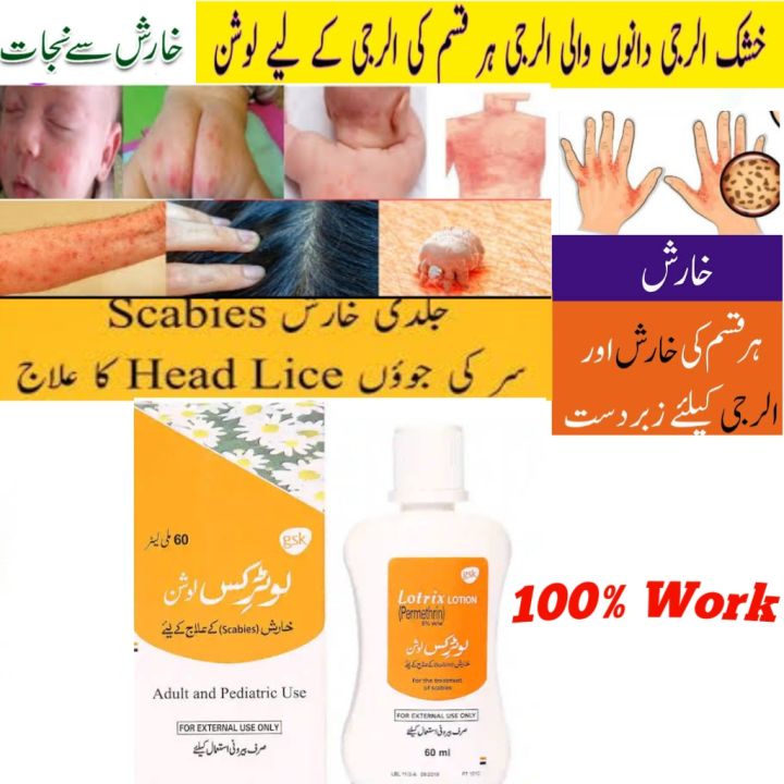 Lotrix%20Lotion%2060ml%20for%20All%20Anti-Allergy%20-%20Image%203