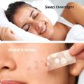 Acne Pimple Patches Invisible Removal Pimple Anti-Acne Hydrocolloid Patches Spots Mark Concealer Waterproof Repair Sticker. 