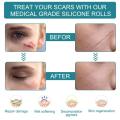 1 Roll Silicone Gel Scar Sheet Patch Treatment Removal Tape Cover Burn Trauma Repair Acne Ear Scar Section Beauty Skin.