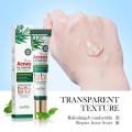 Tea Tree Acni Oil Control gel special skin treatment. 