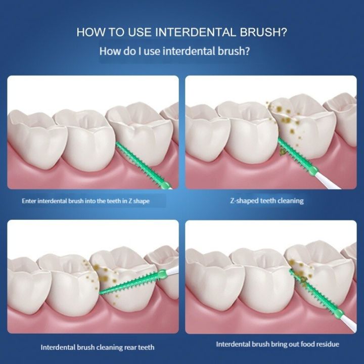 2PCS%20Soft%20Silicone%20Interdental%20Brush%20Toothpick%20Cleaning%20Interdental%20Brush%20Oral%20Care%20Elastic%20Silicone%2020pcs/box%20-%20Image%206