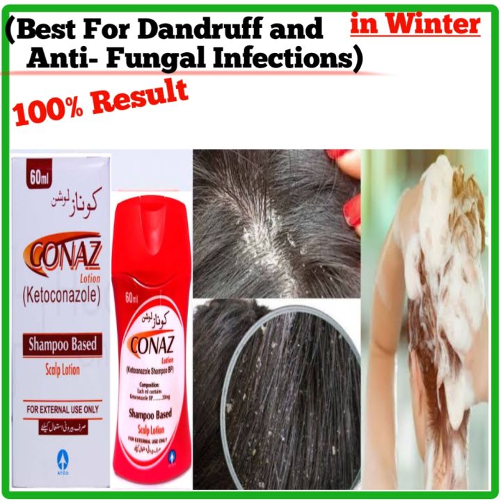 CONAZ%20Shampoo%20based%20Scalp%20lotion%20-%20Image%204