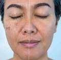 Carenel anti melasma cica cream 40ml. 