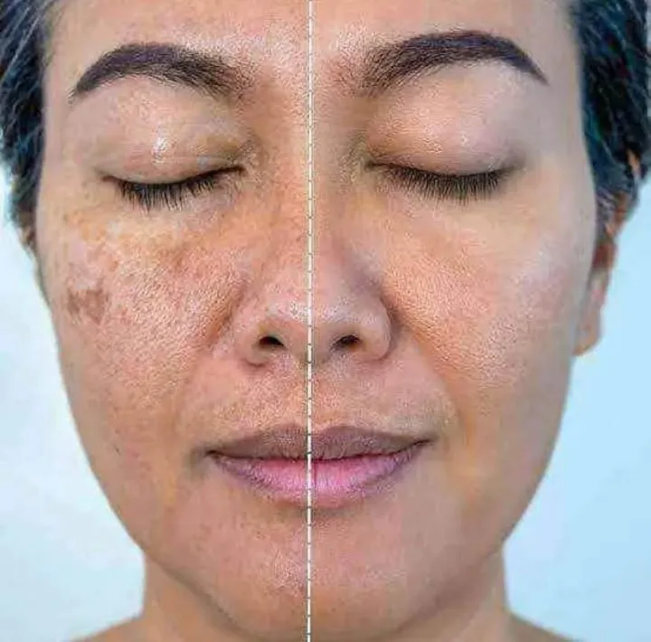 Carenel%20anti%20melasma%20cica%20cream%2040ml%20-%20Image%202