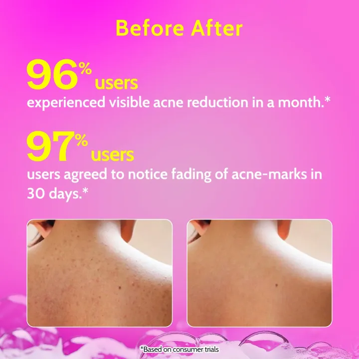 Chemist%20at%20Play%20Body%20Wash%20and%20Shower%20Gel%20For%20Men%20&%20Women%20-%20236ml%20each%20%7C%20Paraben%20&%20SLS%20Free%20Bodywash%20%7C%20From%20HyperMart%20%7C%20Hyper%20Mart%20%7C%20Election%20%7C%20buy%20during%20election%20commission%20nepal%20-%20Image%206