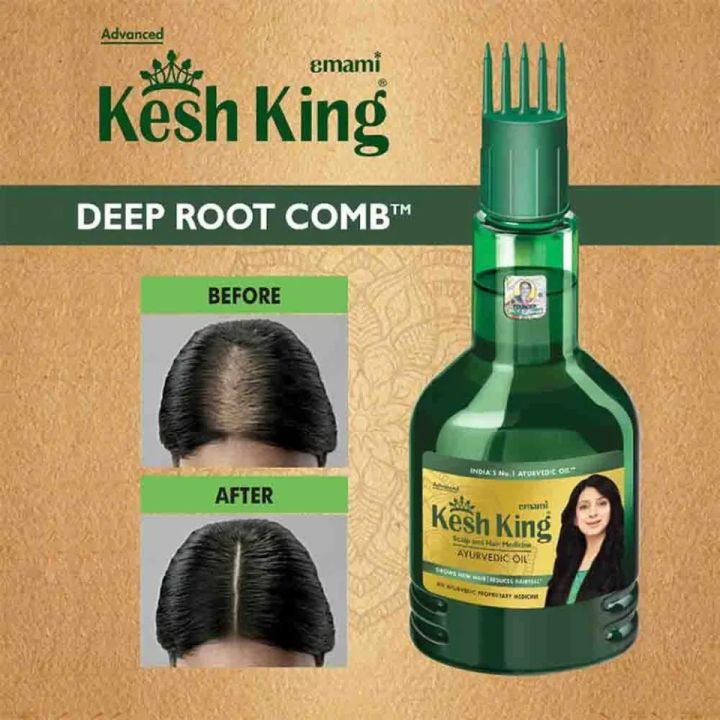 KeshKing%20Ayurvedic%20Hair%20Oil%2050ml%20Nourishing%20Oil%20for%20Hair%20Growth%20and%20Scalp%20Care%20Reduces%20Hair%20Fall%20-%20Image%204