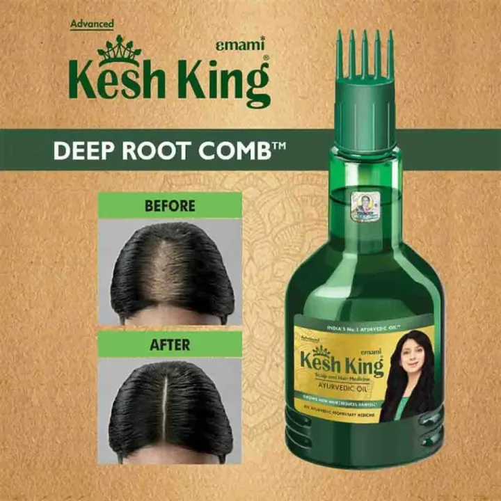 KeshKing%20Ayurvedic%20Hair%20Oil%2050ml%20Nourishing%20Oil%20for%20Hair%20Growth%20and%20Scalp%20Care%20Reduces%20Hair%20Fall%20-%20Image%204