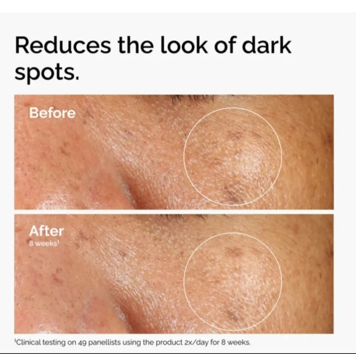 Alpha%20Arbutin%202%25%20+%20HA%20-%2030%20ml%20(Double%20Layer%20Labelling)%20-%20Image%205