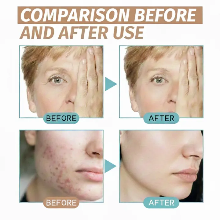 Koral%20Glow%20Zafrani%20Beauty%20Cream%20%7C%20Retinol%20Collagen%20%7C%20Anti-Aging%20Moisturizer%20-%20Image%204