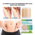 Silicone Scar Sheets Painless Scar Repair Tape Roll Gen 1 Roll/4pc Scar Removal Strips for Face Body Acne Skin Care. 