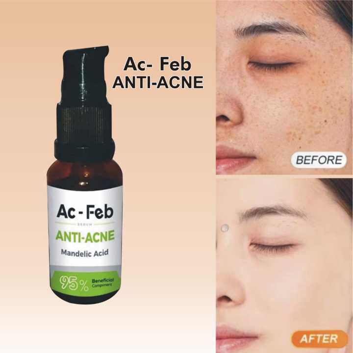 Ac%20Feb%20Anti-Acne%20Serum%20%E2%80%93%2030ml%20-%20Image%202