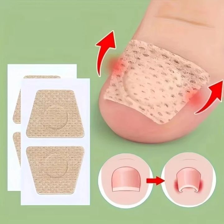 32pcs Nail Repair Patch Grey Fungal Nails Thickening Soft Paronychia Treatment Anti Infection Correction Sticker