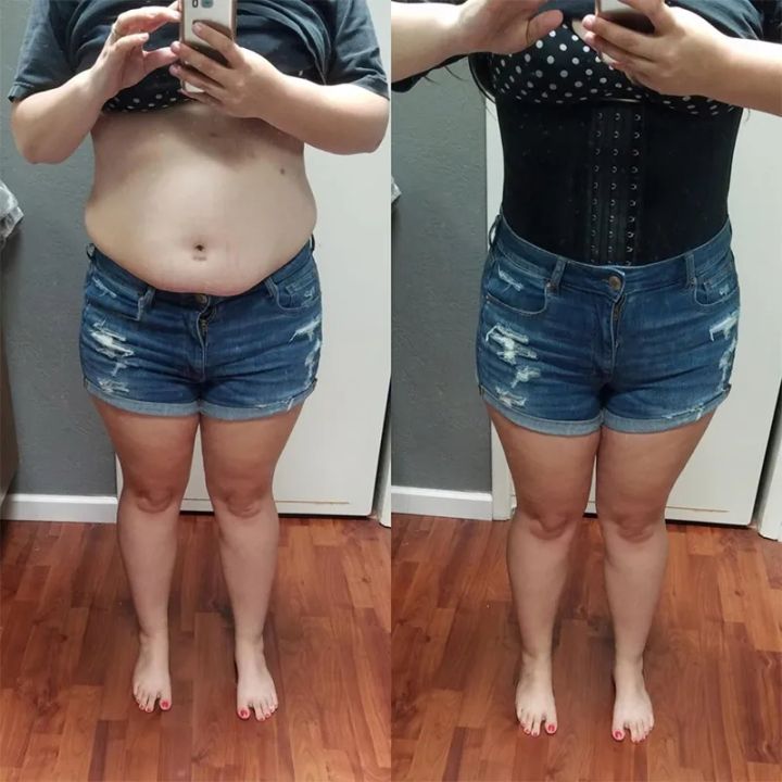 Fajas%20Colombian%20Girdles%20Waist%20Trainer%20Double%20Compression%20BBL%20Shorts%20Tummy%20Control%20Sheath%20Slimming%20Flat%20Stomach%20Modeling%20Belt%20-%20Image%205