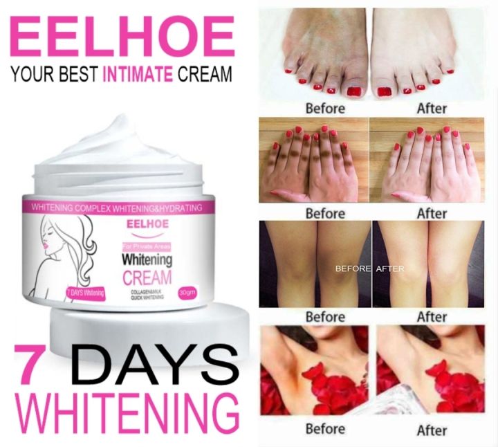 Aveessence%20private%20parts%20whitening%20cream%20for%20dark%20intimate%20areas%20-%20Image%204