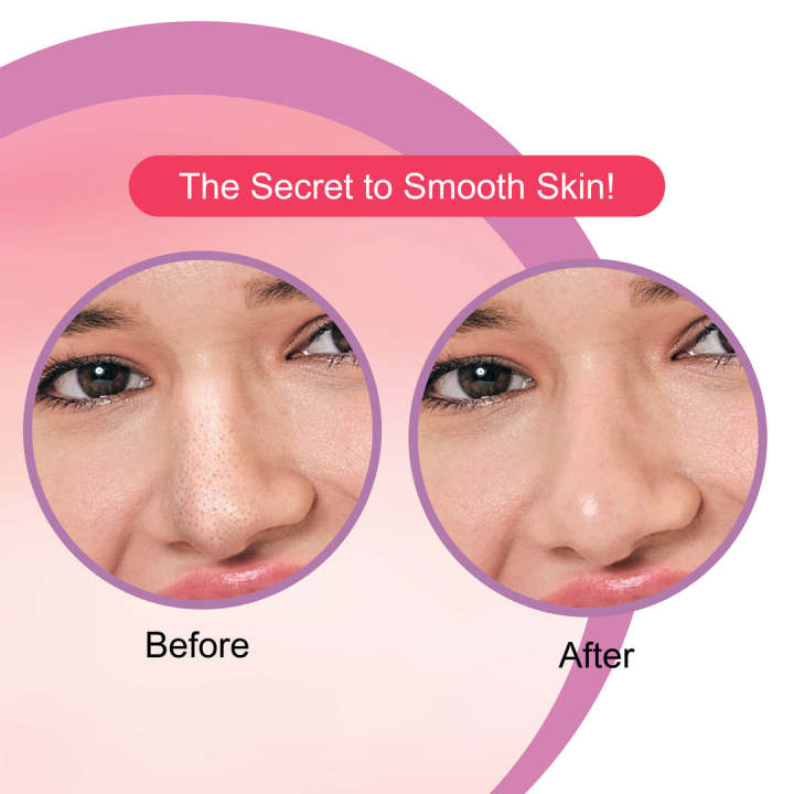 Strawberry%20Nose%20strips%20Remove%20Blackheads,%20Whiteheads,%20and%20Excess%20oil%20-%20Image%204