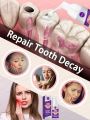 Tooth decay repair Repair all tooth decay, cavities and protect teeth. 