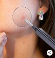 VITCOCO Otoscope Ear Wax Removal 
Visual Digging Ear Spoon 3.0mm Ultra-Thin 
Otoscope Wifi HD Wireless Ear picking 
Mirror Endoscop. 