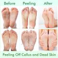 Foot Peel Mask,Exfoliator Peel Off Calluses Dead Skin Callus Remover,Foot Mask for Dry Cracked Feet,Foot Peel Mask with Lavende. 