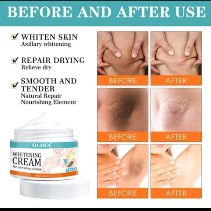 Whitening%20cream%20for%20sensitive%20areas%20underarm%20and%20private%20parts%20of%20body%20men's%20and%20woman%20-%20Image%204