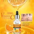 Disaar Vitamin C Face Serum/anti-aging,sunburn & Dark Spots Removal - 30ml. 