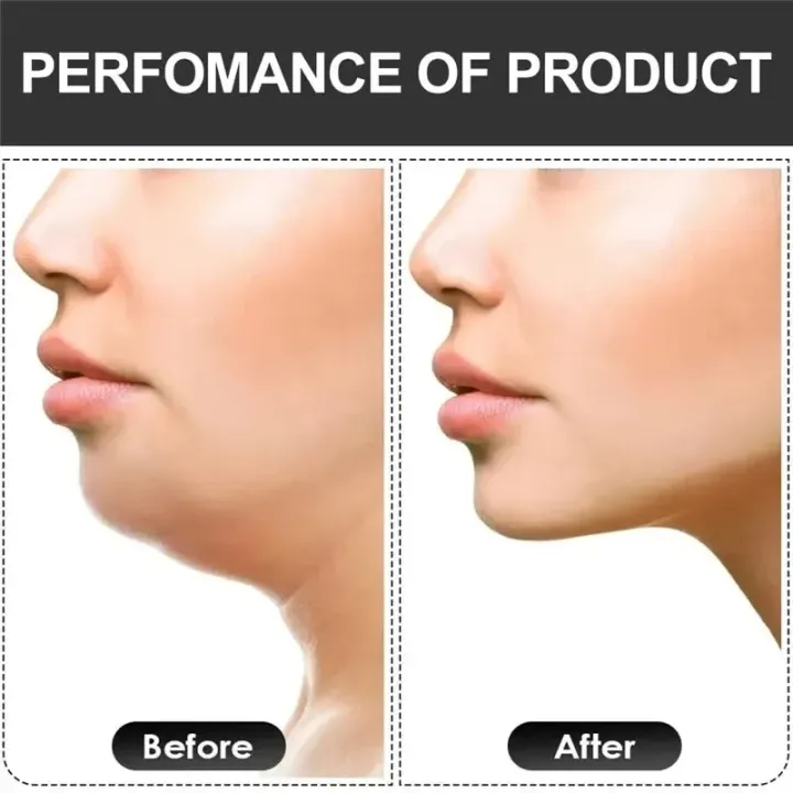U%20Shape%20Jaw%20Exerciser%20New%20Facial%20Mouth%20Jawline%20Face%20Fitness%20Muscle%20Chew%20Ball%20Bite%20Breaker%20Training%20Equipment%20-%20Image%206