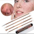 4 Pcs Set Stainless Steel Extractor Blackhead Remover Needles Acne (4 Pcs/Box) - Black Head Remover. 