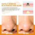 10pcsGentle Cleansing Face Remove Blackhead Acne Nose Strip Remove Grease Peel Clean Blackhead Nose Strip. 