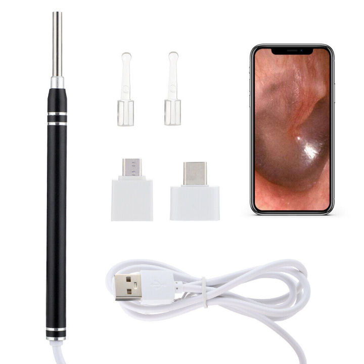 Self-service%20Ear%20Cleaning%20Endoscope%20Set%20Wireless%20Intelligent%20ear%20cleaner%20Earwax%20Remover%20HD%20Camera%20Ear%20Cleaner%20for%20the%20elderly%20-%20Image%203