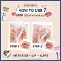 [Ready to Ship] Mediheal Labocare Panteno Lips Healbalm / Healssence 10 ml Lip Balm to Cure Dark Lips, Chapped Lips, and Dark Lips [Me Wealth]. 