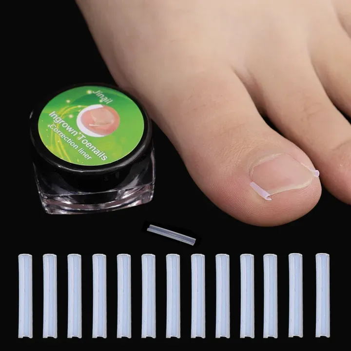 1-100PCS%20Ingrown%20Toenail%20Correction%20Ultra-thin%20Nail%20Treatment%20Elastic%20Patch%20Sticker%20Straightening%20Nails%20Groove%20Ingrown%20Corrector%20-%20Image%204