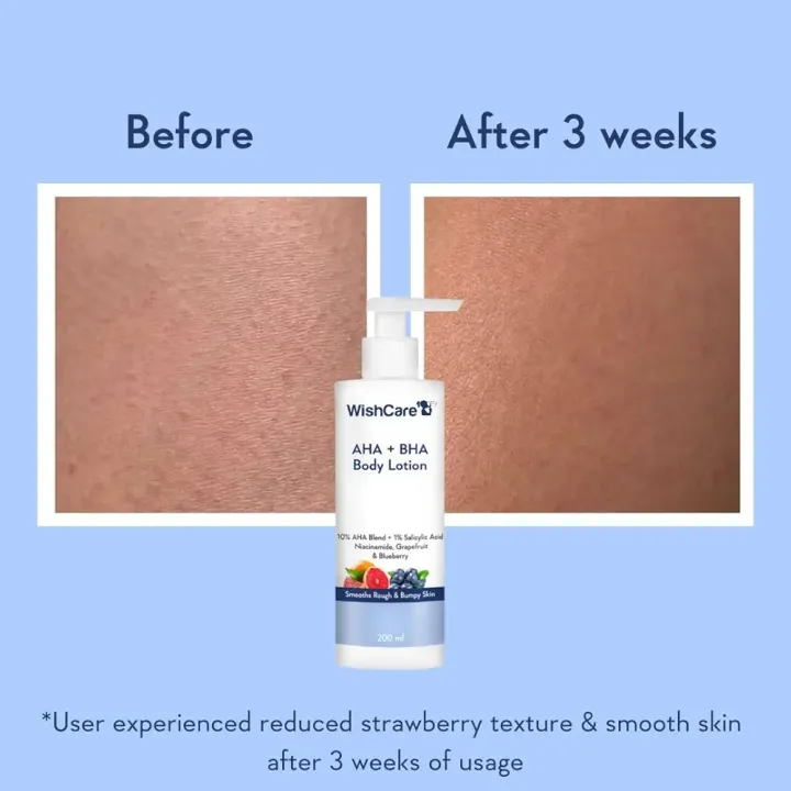 Int.%20WishCare%2010%25%20AHA%20+%201%25%20BHA%20Body%20Lotion%20%20200%20ml%20-%20Image%202