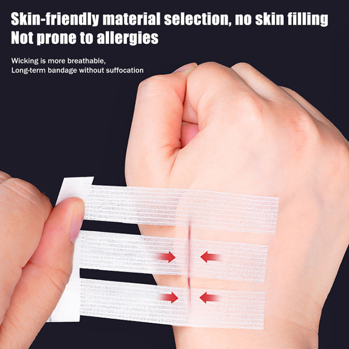 3/5/6Pcs/pack Wound Closure Tape Adhesive Sterile Medical Bandage Strip ...