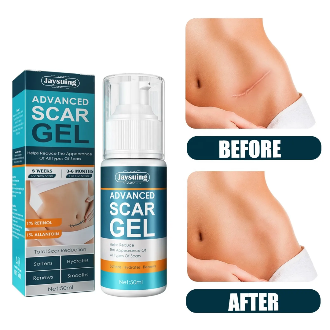 Jaysuing Advanced Scar Gel 50ml