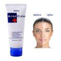 International Product Mistine Acne Clear Facial Foam
Face wash  - 85gm. 