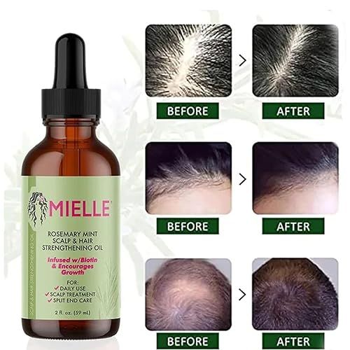 Mielle%20Organics%20Rosemary%20Mint%20Scalp%20&%20Hair%20Strengthening%20Oil%20for%20All%20Hair%20Types%2059ml%20-%20Image%206