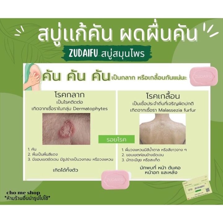 Zudaifu%20sulfur%20soap%2080g%20100%25%20genuine%20zudaifu%20sulfur%20soap%20natural%20herbal%20soap%20sulfur%20skin%20care%20soap%20body%20wash%20acne%20care%20soap%20whitening%20natural%20wash%20bath%20-%20Image%205